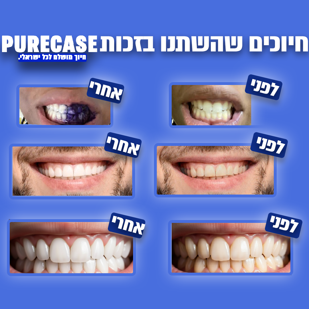 PureCase™- מארז ההלבנה שכבש את ישראל